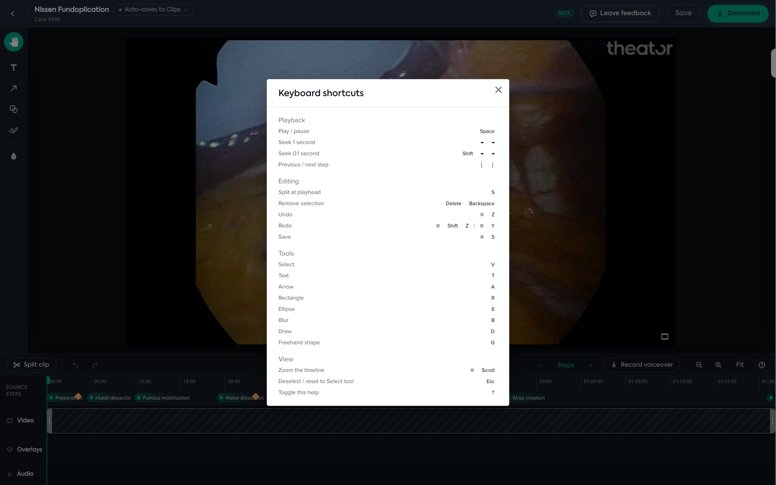 The editor's keyboard shortcuts panel