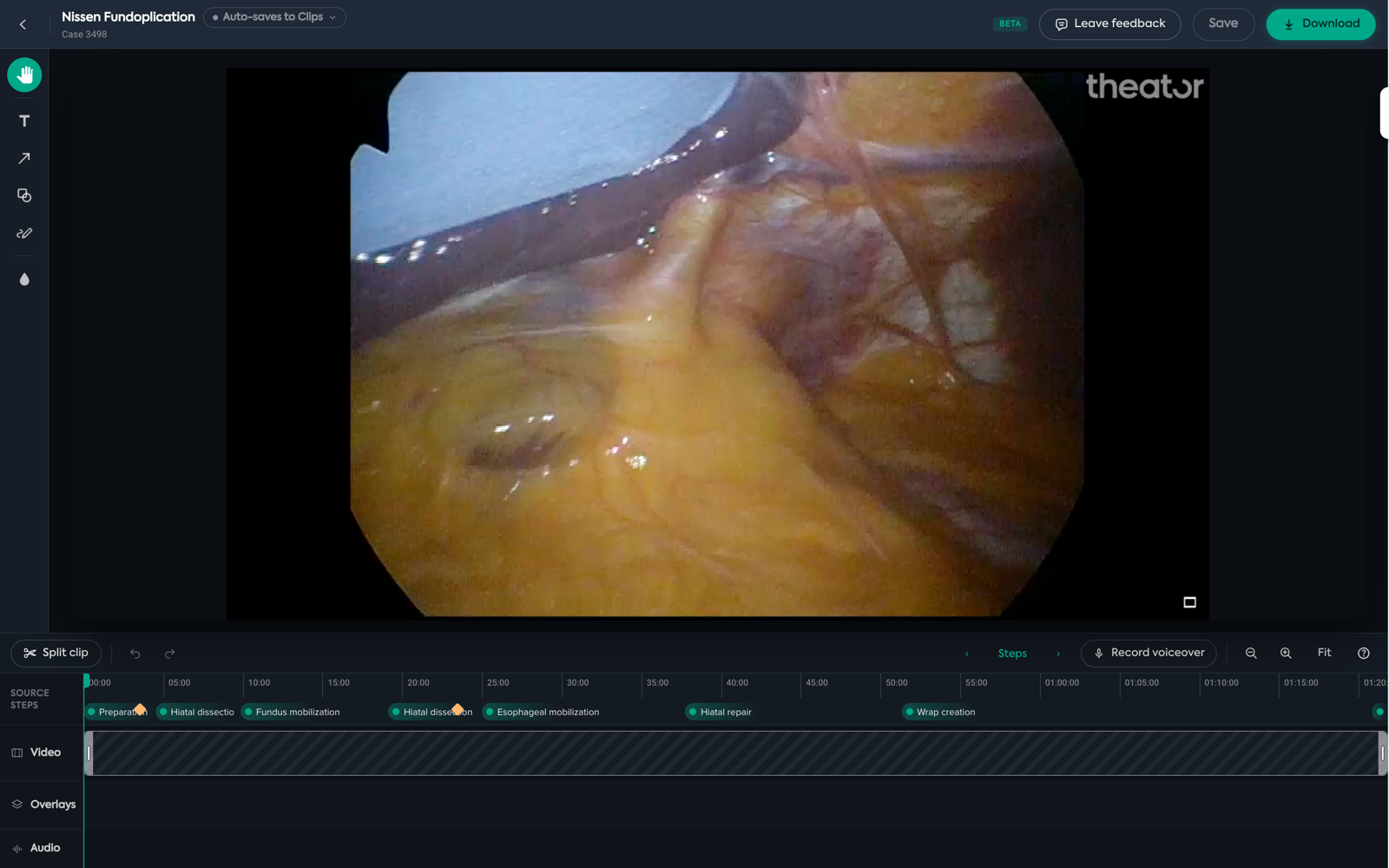 The video editor's three bands: top bar, tool rail and video stage, and the timeline