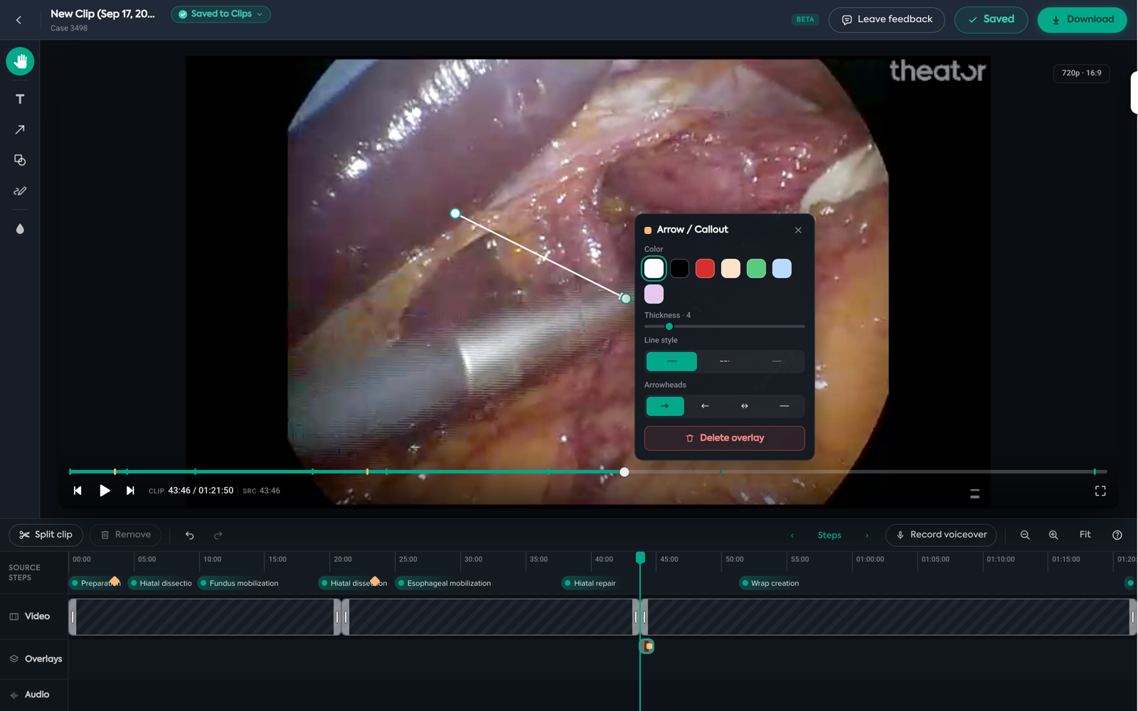 Three segments on the Video lane after two splits, with an arrow annotation selected and its inspector open